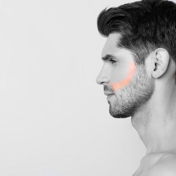 Cheek| Beard Line