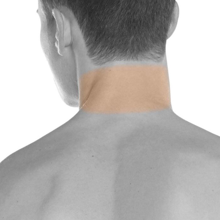 Hairline (back)