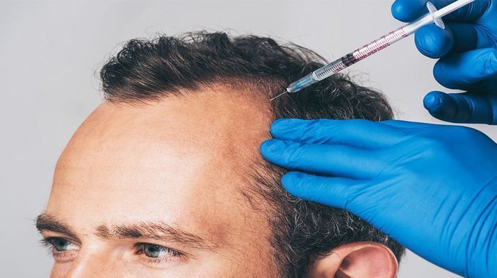 Placelet - Rich Plasma (PRP) Hair Growth